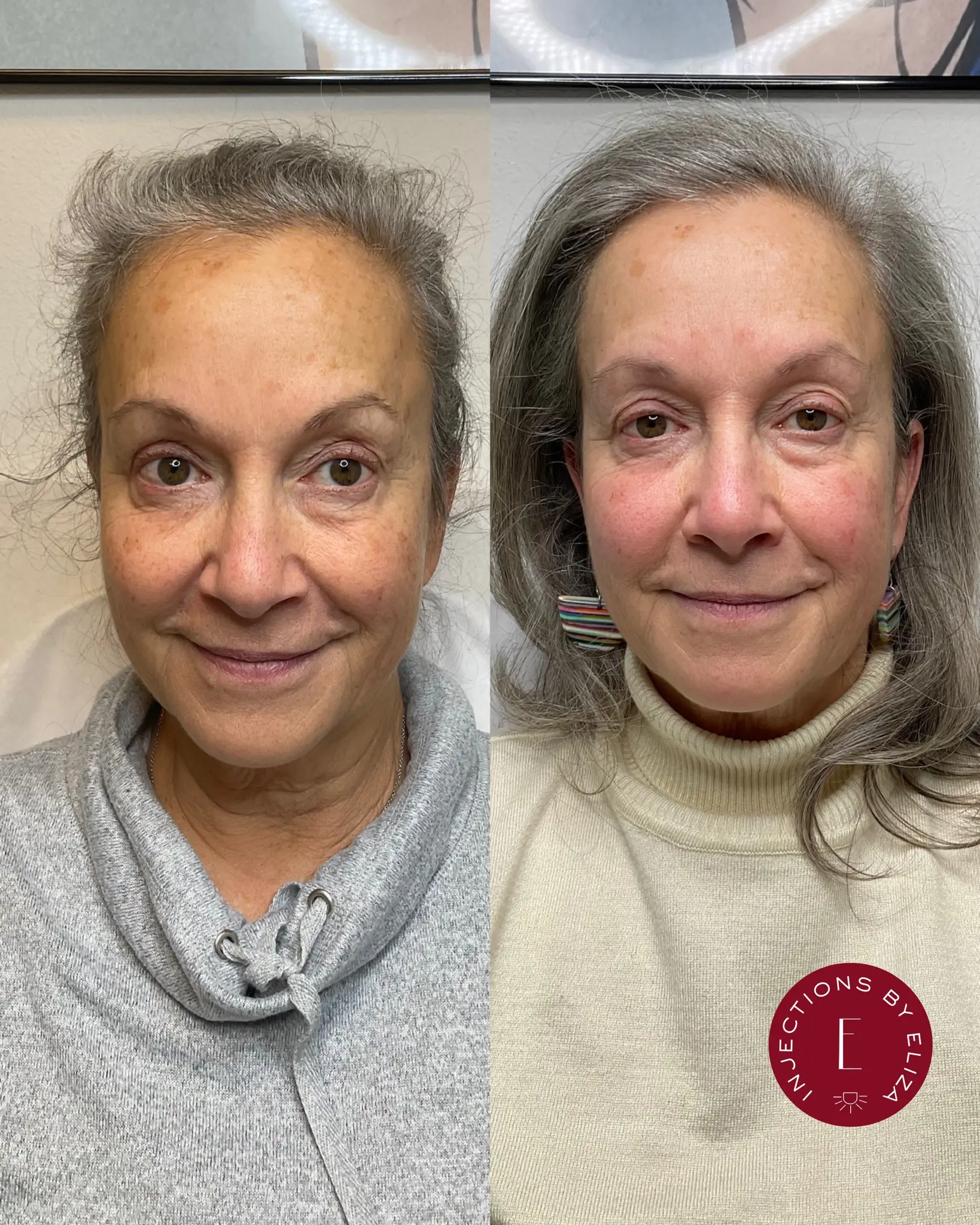 Treat aging concerns, 1