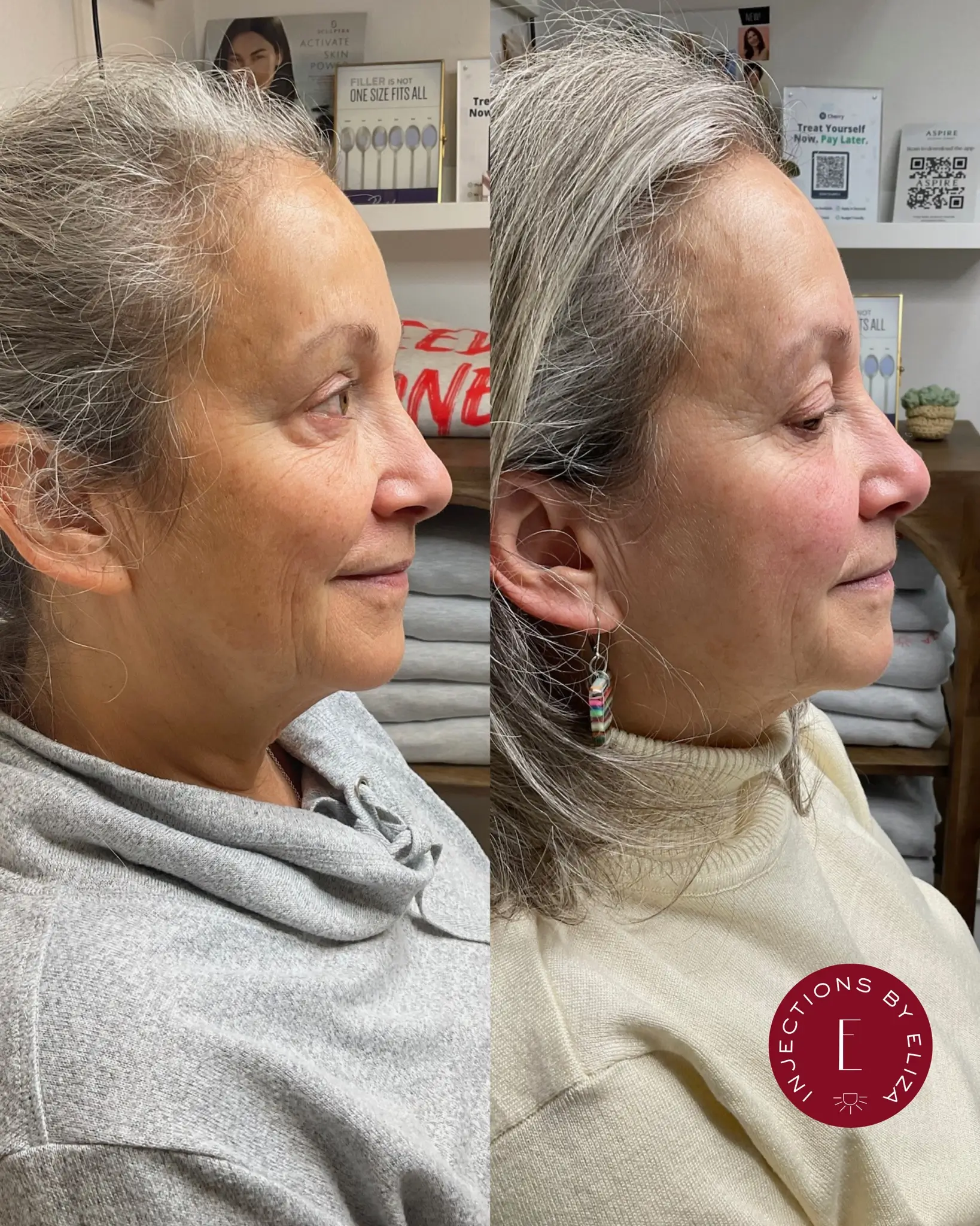 Treat aging concerns, 2