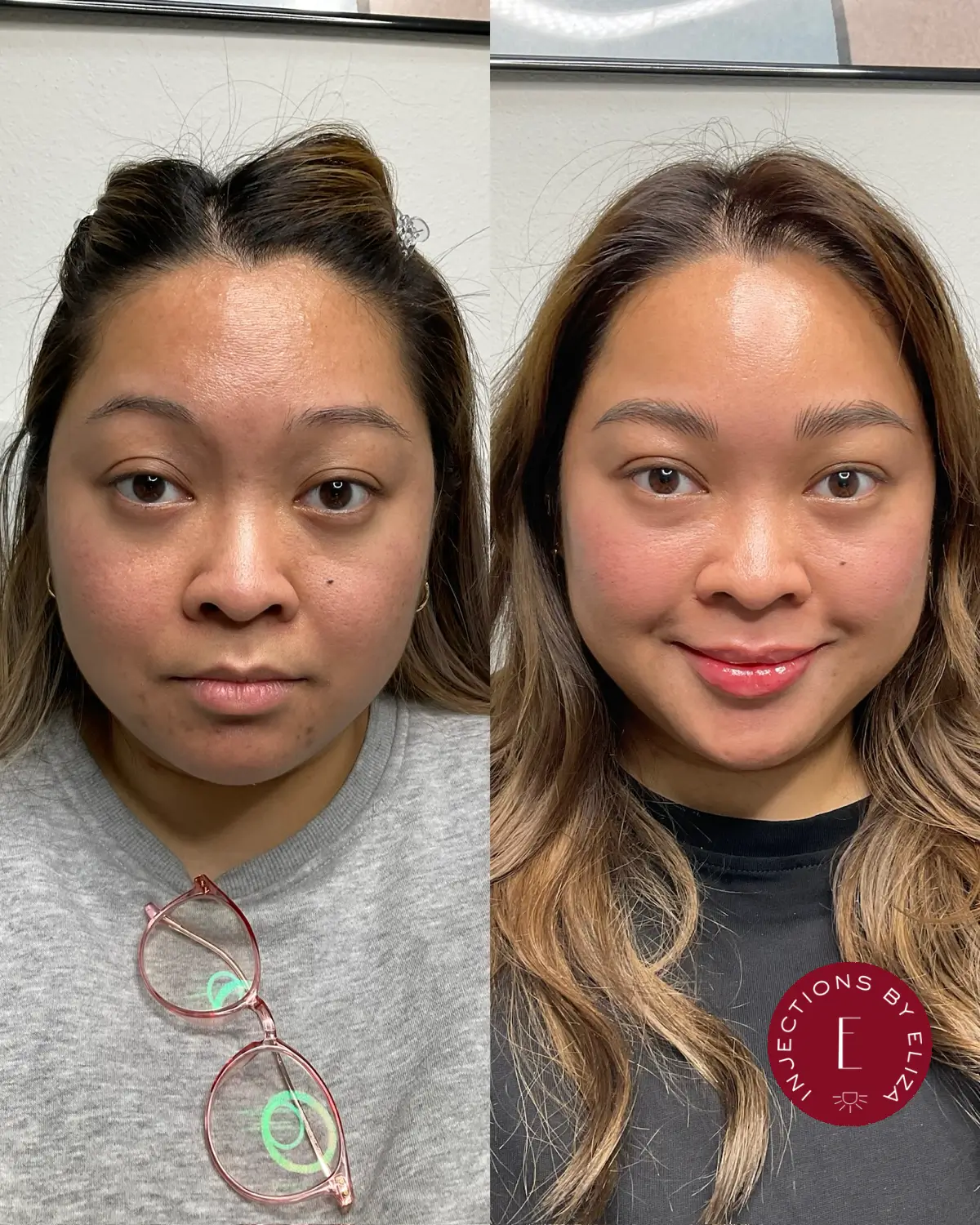 preventative treatments 1